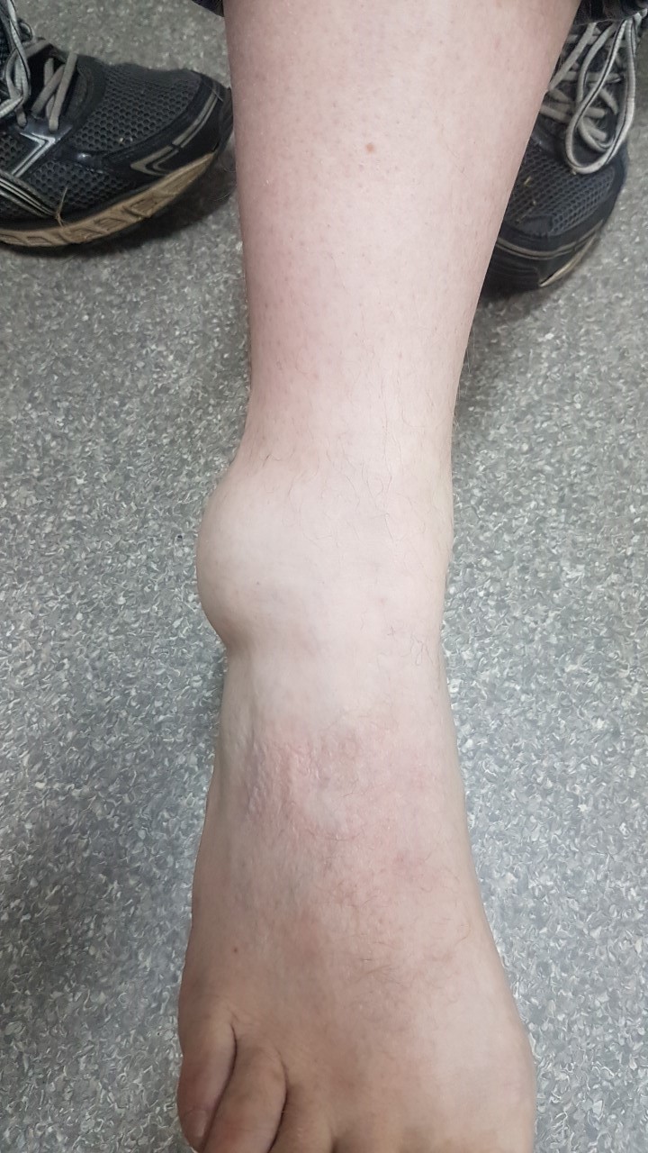 ankle.jpg